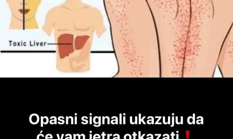 Pogledajte kako prepoznati da ce vam jetra uskoro otkazati