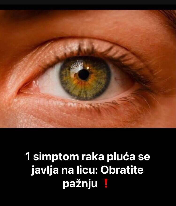 Vaše oči mogu vam otkriti da li imate rak pluća