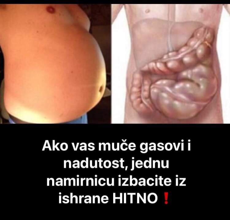 Pogledajte koje namirnice uzrokuju gasove i nadutost