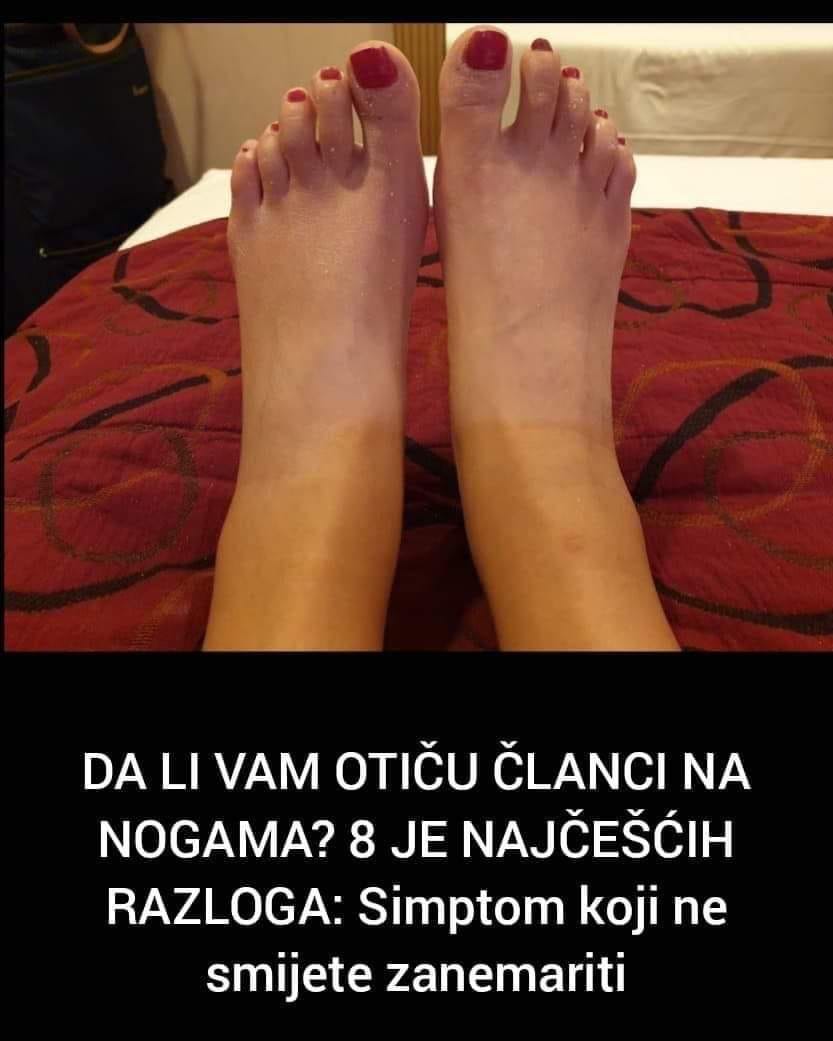 Ako vam otiču članci nemojte to zanemariti, ovo je 8 razloga zbog kojih se to dešava