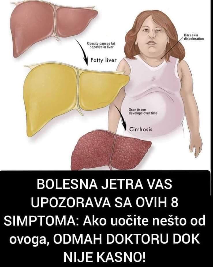 Pogledajte prve znakove, da vam je jetra oboljela