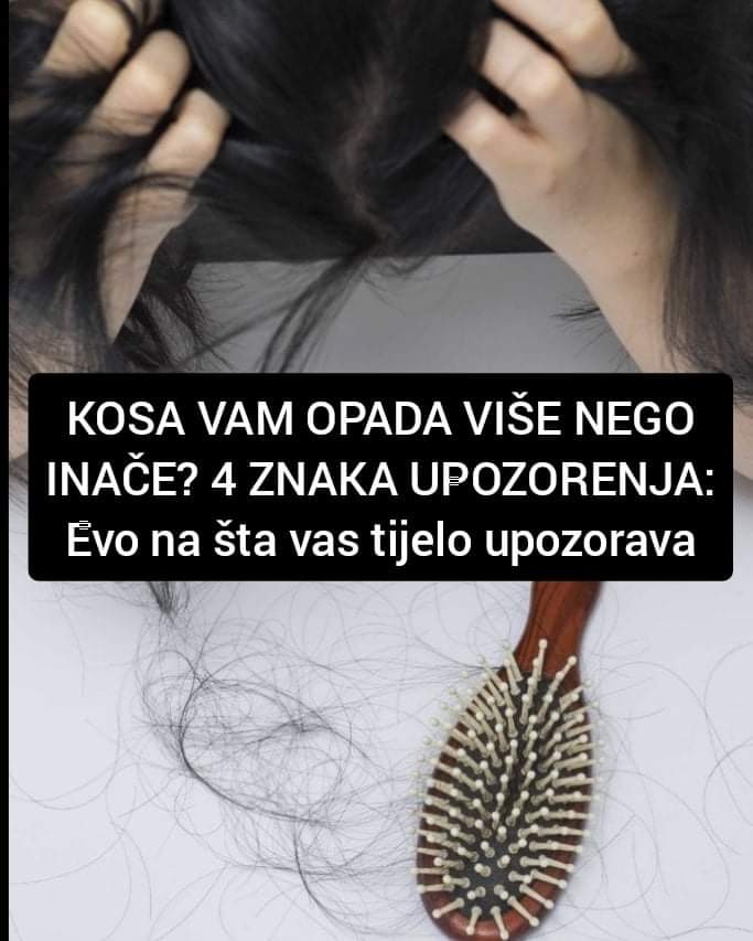 Pogledajte zašto vam kosa opada više nego inače