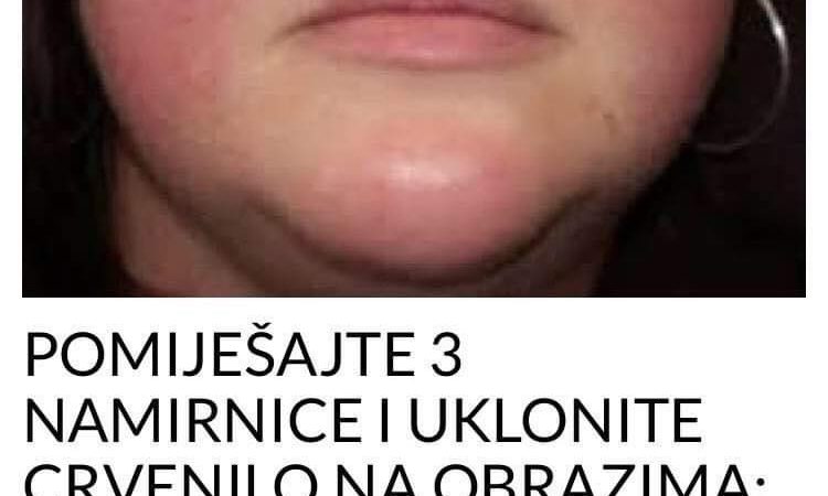 NAPRAVITE SAMI MASKU ZA REGENERACIJU KOZE OD TRI SASTOJKA KOJE IMATE U KUCI