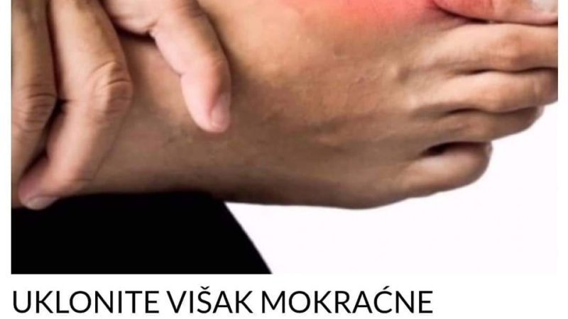 POGLEDAJTE POMOCU KOJA 3 PRIRODNA LIJEKA MOZETE DA UKLONITE VISAK MOKRACNE KISELINE